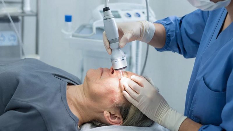 Лазерное удаление гигантских пигментных невусов