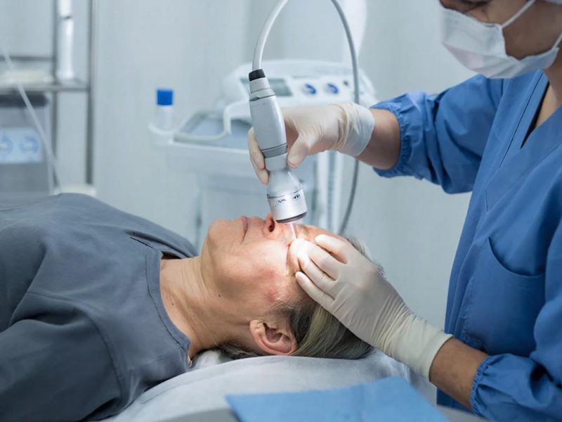 Лазерное удаление гигантских пигментных невусов